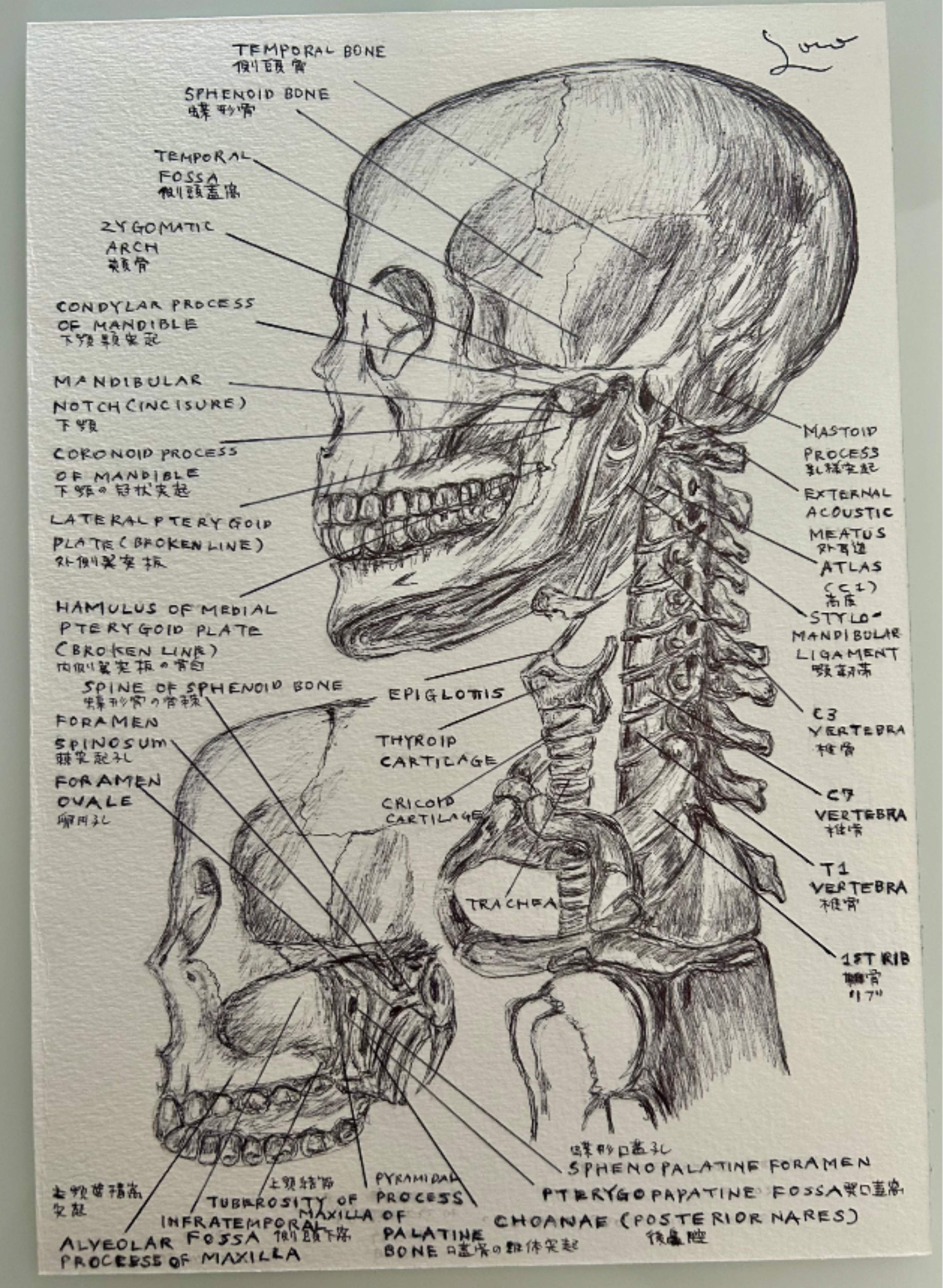 Ballpen Medical 🏥 Drawing ✍🏻 Bones 🦴